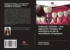 Bookcover of Implants inclinés : une approche clinique du maxillaire et de la mandibule atropiques