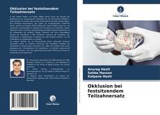 Bookcover of Okklusion bei festsitzendem Teilzahnersatz