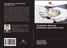 Bookcover of Occlusion dans les prothèses partielles fixes