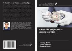 Buchcover von Oclusión en prótesis parciales fijas