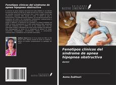 Buchcover von Fenotipos clínicos del síndrome de apnea hipopnea obstructiva