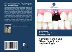 Bookcover of Komplikationen und Misserfolge in der Implantologie