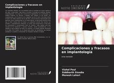 Bookcover of Complicaciones y fracasos en implantología