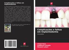 Portada del libro de Complicações e falhas em Implantodontia
