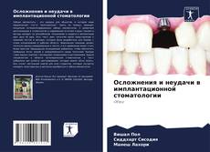 Bookcover of Осложнения и неудачи в имплантационной стоматологии