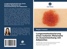 Capa do livro de Lungenmetastasierung eines kutanen Melanoms im Zusammenhang mit Adipositas 