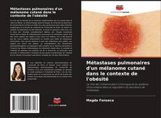 Capa do livro de Métastases pulmonaires d'un mélanome cutané dans le contexte de l'obésité 