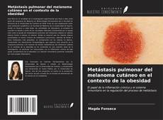 Buchcover von Metástasis pulmonar del melanoma cutáneo en el contexto de la obesidad