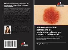 Borítókép a  Metastatizzazione polmonare del melanoma cutaneo nel contesto dell'obesità - hoz