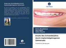 Buchcover von Ersatz des Schneidezahns durch implantatgetragenen Zahnersatz