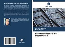 Buchcover von Plattformwechsel bei Implantaten