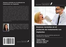 Bookcover of Avances recientes en el protocolo de tratamiento con implantes