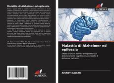Buchcover von Malattia di Alzheimer ed epilessia