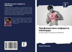 Bookcover of Профилактика инфаркта миокарда