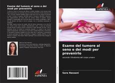 Bookcover of Esame del tumore al seno e dei modi per prevenirlo