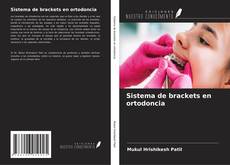 Bookcover of Sistema de brackets en ortodoncia