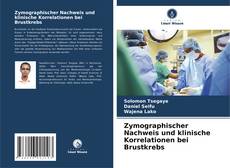 Bookcover of Zymographischer Nachweis und klinische Korrelationen bei Brustkrebs