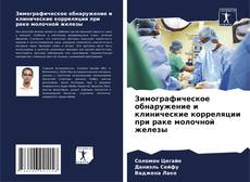 Capa do livro de Зимографическое обнаружение и клинические корреляции при раке молочной железы 