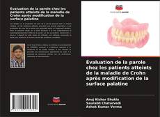 Buchcover von Évaluation de la parole chez les patients atteints de la maladie de Crohn après modification de la surface palatine