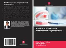 Buchcover von Scaffolds na terapia periodontal regenerativa