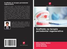 Scaffolds na terapia periodontal regenerativa的封面