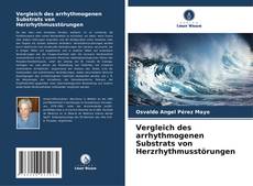 Bookcover of Vergleich des arrhythmogenen Substrats von Herzrhythmusstörungen