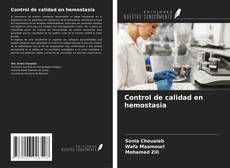 Buchcover von Control de calidad en hemostasia
