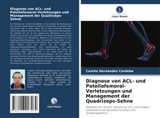 Diagnose von ACL- und Patellofemoral-Verletzungen und Management der Quadrizeps-Sehne kitap kapağı