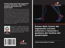 Buchcover von Esame delle lesioni del legamento crociato anteriore e femorale e gestione del tendine del quadricipite