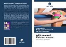 Bookcover of Adhäsion nach Knieoperationen