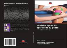 Bookcover of Adhésion après les opérations du genou