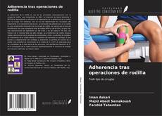 Adherencia tras operaciones de rodilla kitap kapağı