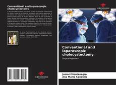 Buchcover von Conventional and laparoscopic cholecystectomy