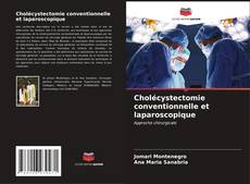 Buchcover von Cholécystectomie conventionnelle et laparoscopique