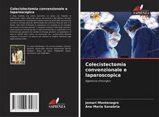 Buchcover von Colecistectomia convenzionale e laparoscopica