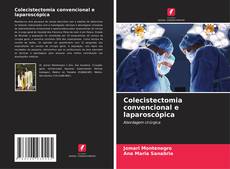 Colecistectomia convencional e laparoscópica的封面