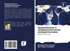 Capa do livro de Традиционная и лапароскопическая холецистэктомия 