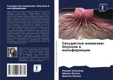 Buchcover von Сосудистые аномалии: Опухоли и мальформации