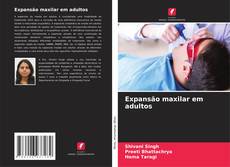 Expansão maxilar em adultos的封面