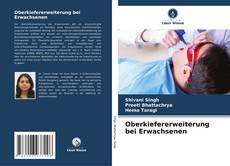 Bookcover of Oberkiefererweiterung bei Erwachsenen