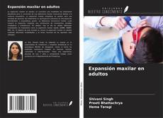 Bookcover of Expansión maxilar en adultos
