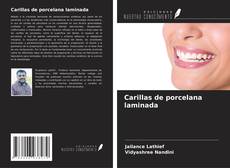Bookcover of Carillas de porcelana laminada