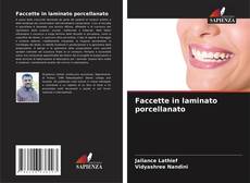 Bookcover of Faccette in laminato porcellanato