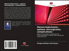 Bookcover of Hémorroïdectomie : options chirurgicales, complications