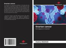 Bookcover of Ovarian cancer