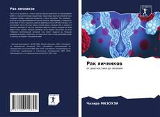 Bookcover of Рак яичников