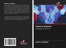 Bookcover of Cancro ovarico