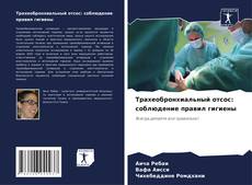 Bookcover of Трахеобронхиальный отсос: соблюдение правил гигиены