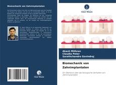 Biomechanik von Zahnimplantaten kitap kapağı