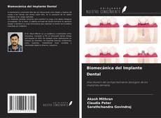 Biomecánica del Implante Dental kitap kapağı